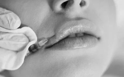 How-much-does-it-cost-to-get-lip-filler-UK