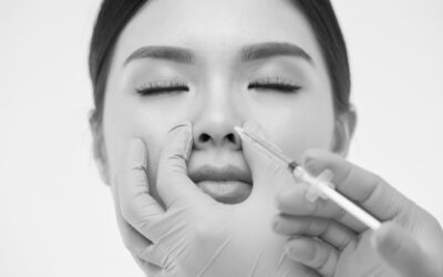 How Long Do Nose Dermal Fillers Last in the Nose?